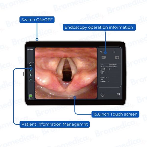 Hugemed Bronchoscope Reusable M52 (Diagnose the cause of lung and airway problems) - Image 4